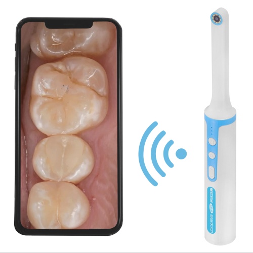 Wi-Fi- видеоскоп стоматолога МЕГЕОН 33038 - внешний вид фото 13 Wi-Fi- видеоскоп стоматолога МЕГЕОН 33038 фотография фото 13